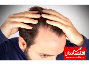 معجزه باورنکردنی این روغن مو در رشد موها