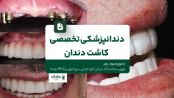 دندانپزشکی تخصصی کاشت دندان